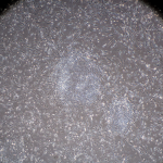 induced pluripotent stem cells