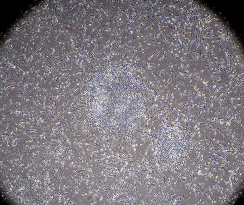 What Are Induced Pluripotent Stem Cells (iPSCs)?