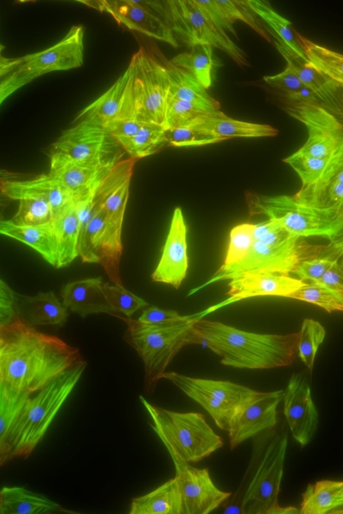 Microscope shot of cardiac tissue
